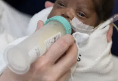 A medically fragile infant receiving donor human milk