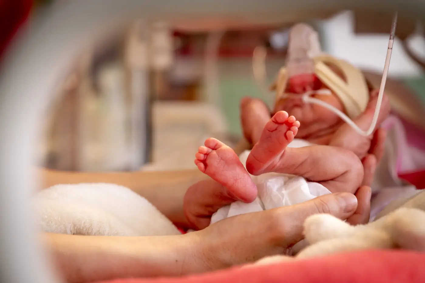 A tiny infant being gently cradled in neonatal intensive care