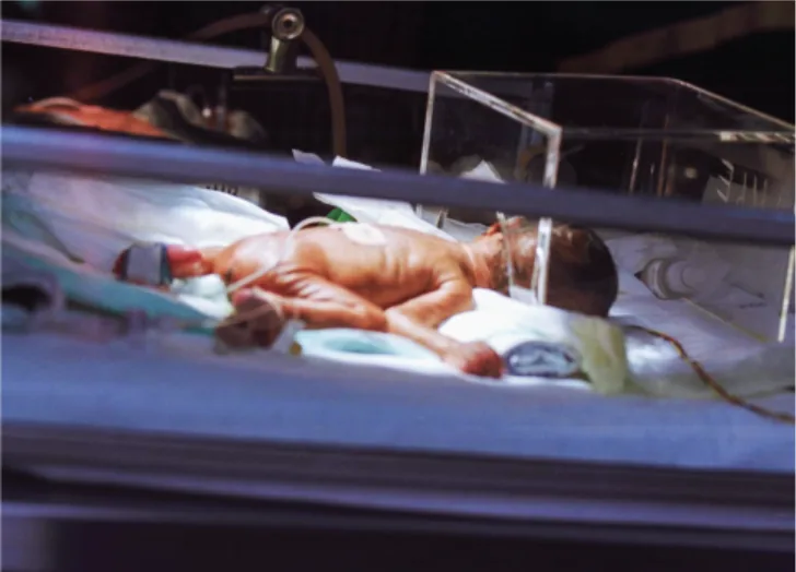 A very premature infant receiving care in an incubator